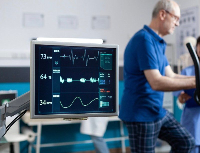 Monitors - Med Supplies Hub 